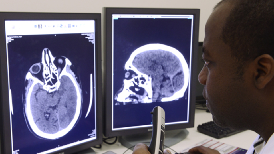 Docteur examinant un IRM du cerveau au CHSF
